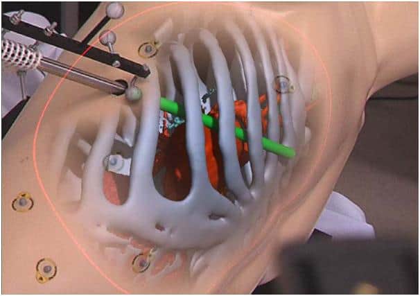 Market research firm Global Industry Analysts says the global market for 3D medical imaging will reach (US) $5.9 Billion by 2017.