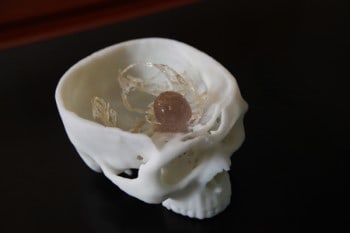 Model to practice brain tumour removal. Source: 3DPrinter.net