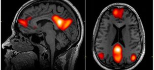 fMRI results