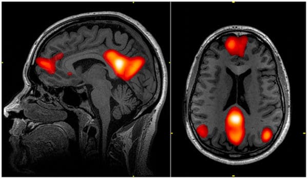 fMRI results