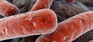 Tuberculosis scare in Calgary