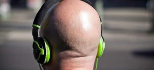 bald men prostate cancer