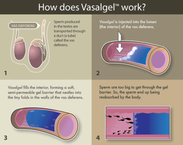 contraceptive gel