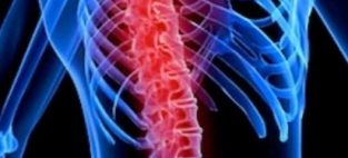 stem cell therapy spinal cord